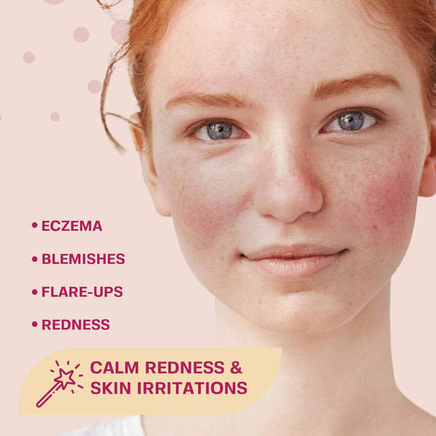 TSBL25 - Hypochlorous Acid Spray