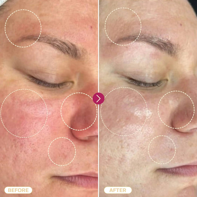 TSBL25 - Hypochlorous Acid Spray