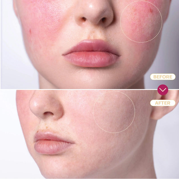 TSBL25 - Hypochlorous Acid Spray